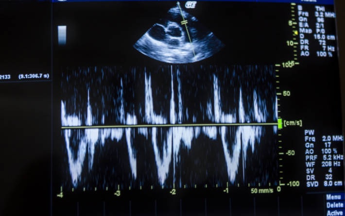 산전검사 완벽 타임라인